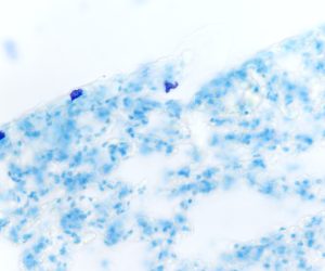 Bleu-Toluidine