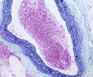 Trichrome-Masson-Verhoeff